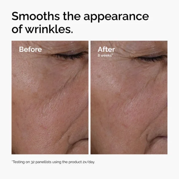 ord-multi-peptide-ha-serum-wrinkles-before-after Multi-Peptide + HA Serum